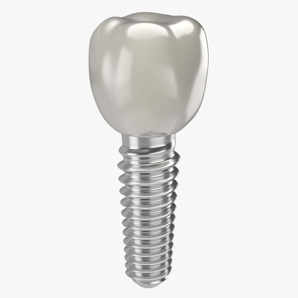Dental Implant